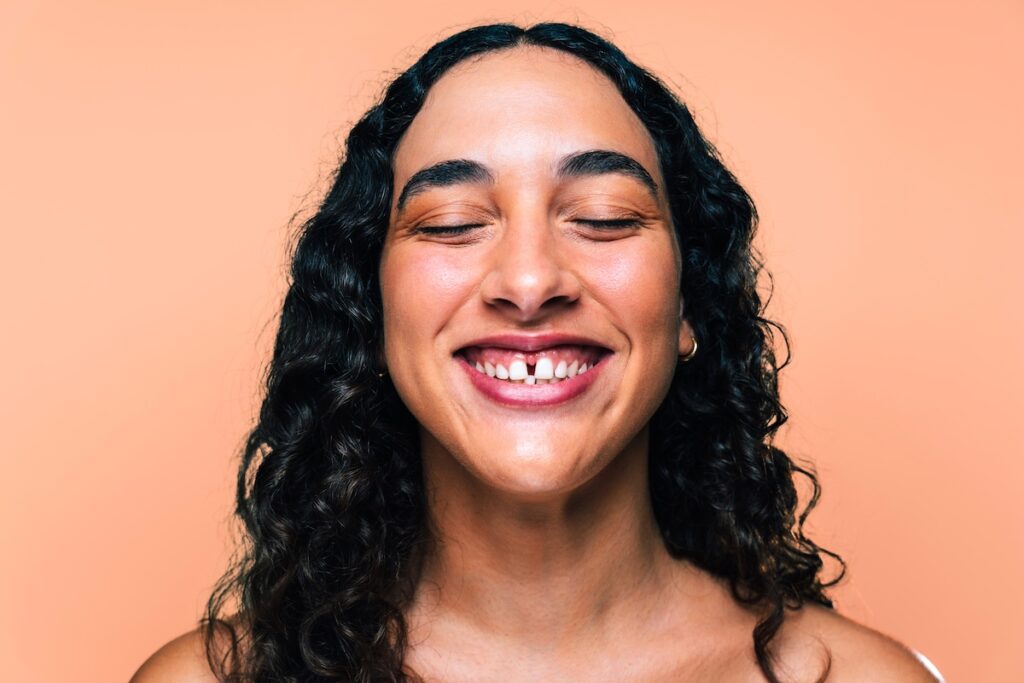 szpara między zębami