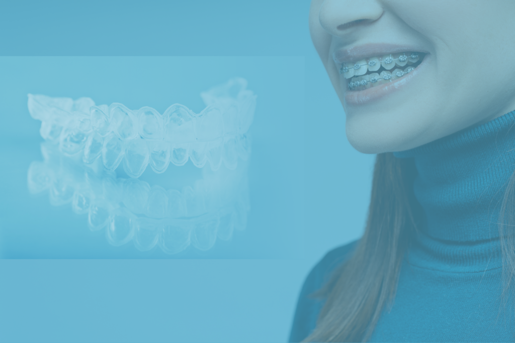 Invisalign czy zwykły aparat