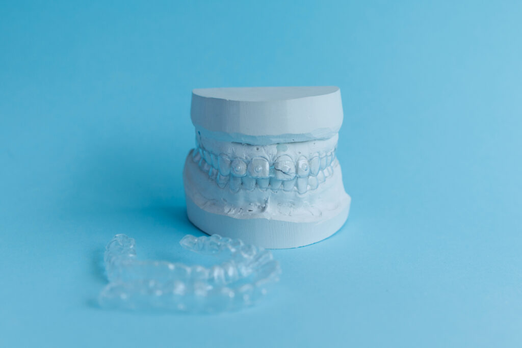 aparat-nakladkowy-invisalign-czy-zwykly-aparat