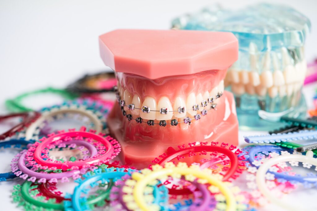 zwykły aparat czy invisalign